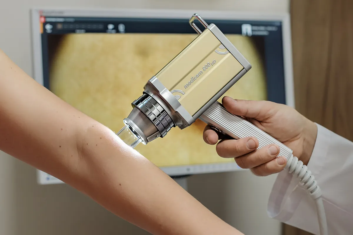Kursy dermatoskopowe w Akademii Dermatoskopii