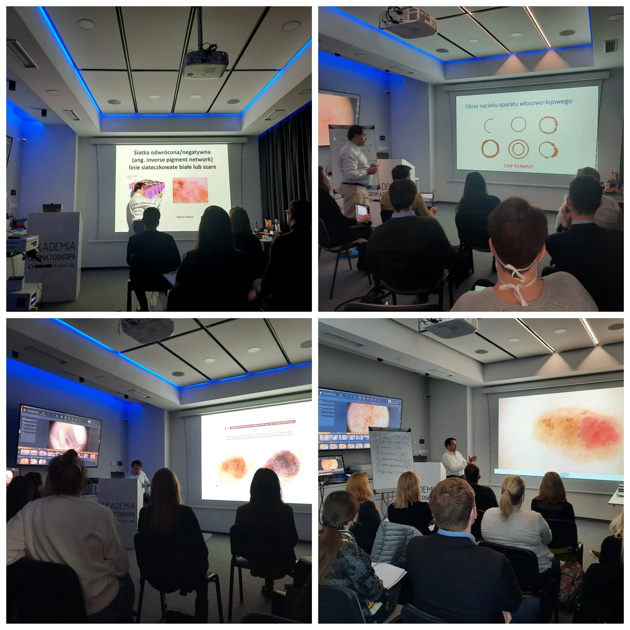 Kolejny kurs dermatoskopowy na poziomie podstawowym tuż po V Konferencji Akademii Dermatoskopii! Termin: 22-23.04.2022!