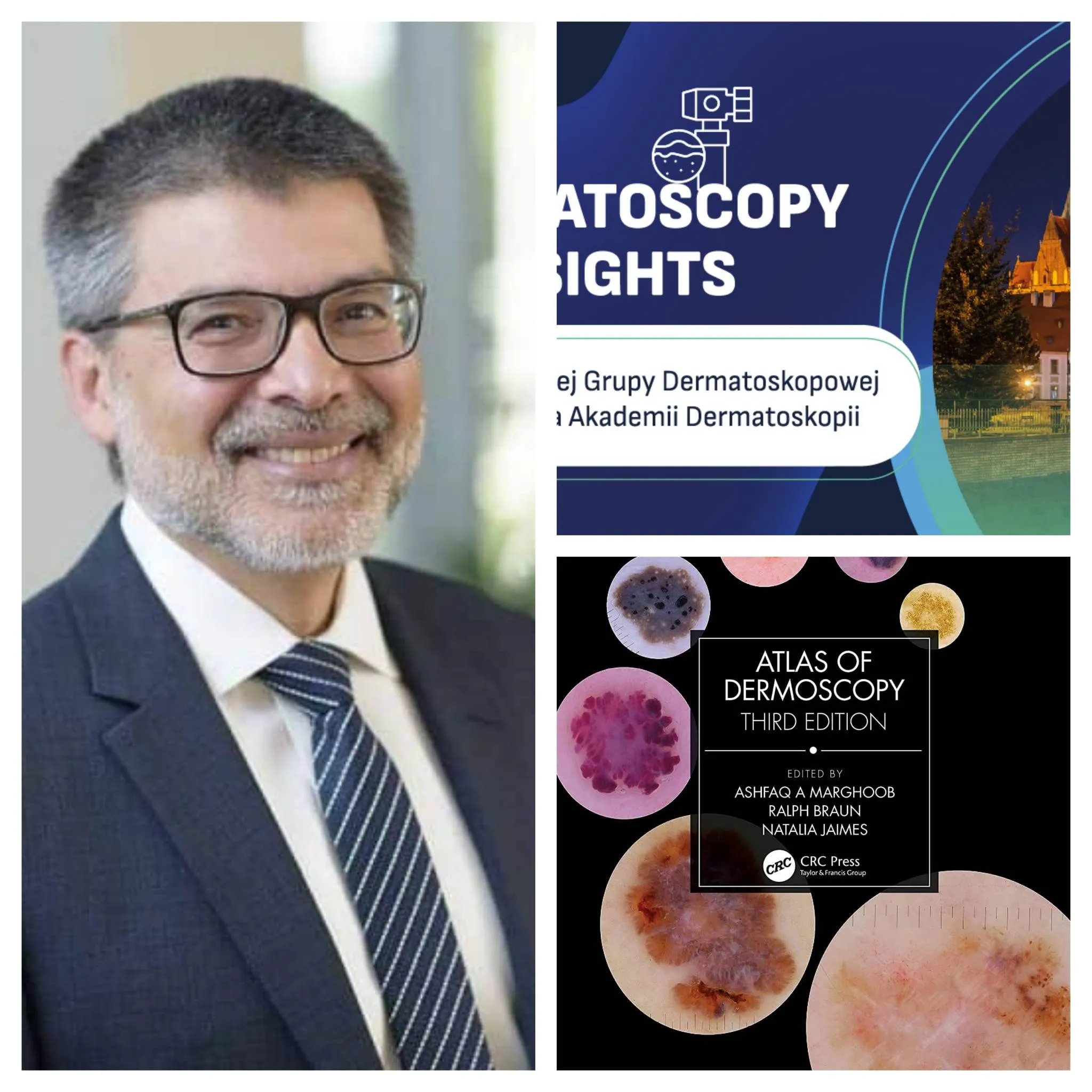 Prosto ze Stanów Zjednoczonych, autor jednego z najbardziej znanych na świecie atlasów dermatoskopowych profesor Ashfaq Marghoob z Memorial Sloan Kettering Skin Cancer Center gościem specjalnym Konferencji naukowej „Dermatoscopy insights”!!!